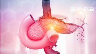 Điều trị u tuyến tụy tiết insulin