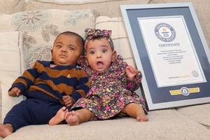 Cặp song sinh lập kỷ lục thế giới về sinh non và nhẹ cân