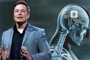Công ty của tỷ phú Mỹ Elon Musk được phép thử nghiệm cấy chip vào não người
