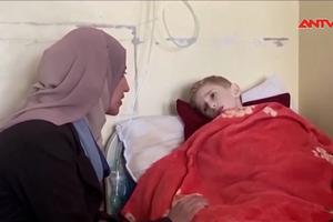 Những đứa trẻ chết dần vì đói ở Gaza