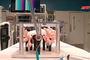 Robot giúp chẩn đoán ung thư phổi