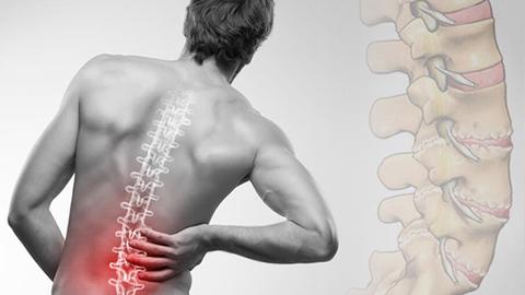 Cảnh báo bệnh lý cột sống ngày càng nghiêm trọng