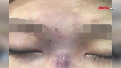 Cảnh báo từ hậu quả của việc làm đẹp bất chấp