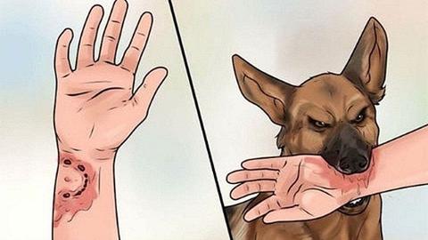 Nguy cơ gia tăng bệnh dại trong mùa hè 