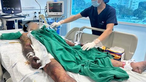 Người đàn ông nguy kịch sau khi ăn tiết canh