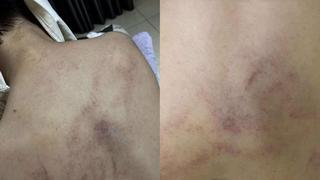 Hà Nội: Tạm đình chỉ giáo viên mầm non bạo hành bé gái