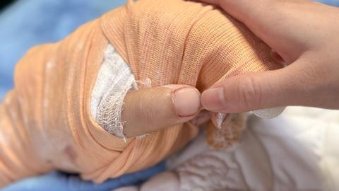 Điều tra vụ TikToker Hà List bị chém gần đứt lìa bàn tay