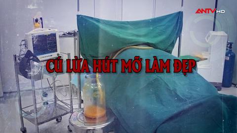 Cú lừa hút mỡ làm đẹp