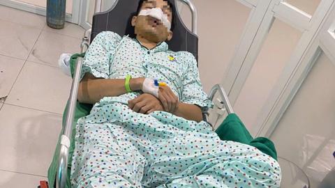 Xác minh vụ bảo vệ chợ đầu mối Hóc Môn đánh người