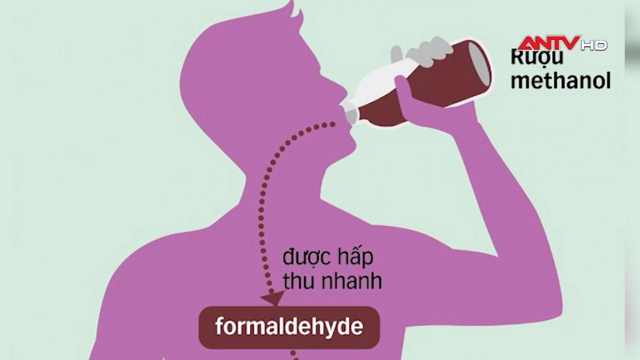 Hải Phòng: 1 người chết, 6 người nhập viện do ngộ độc rượu ngâm