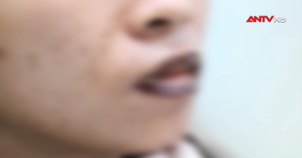 Làm đẹp cấp tốc đón Tết - lợi bất cập hại