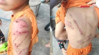 Đắk Lắk: Điều tra vụ bé trai 10 tuổi bị bố bạo hành