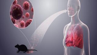 Bộ Y tế cảnh báo khẩn về loại virus lây từ chuột 