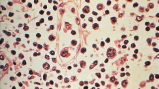  Đài Loan (Trung Quốc) ghi nhận 1 ca tử vong do nhiễm virus Hanta