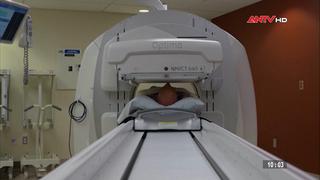  Kỹ thuật mới xét nghiệm máu phát hiện sớm bệnh Alzheimer