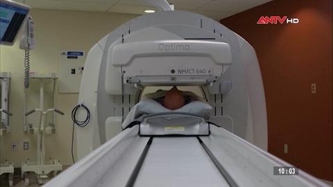  Kỹ thuật mới xét nghiệm máu phát hiện sớm bệnh Alzheimer