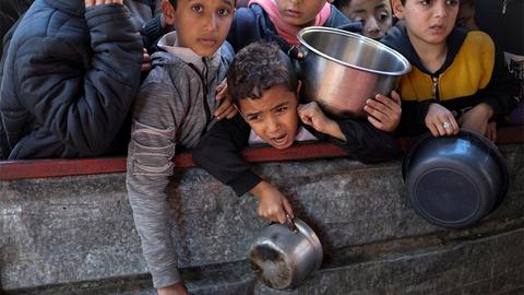 Nỗi đau thầm lặng của trẻ em mắc hội chứng down ở Gaza