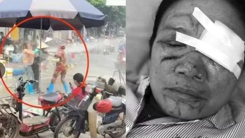 Khởi tố đối tượng xịt nước áp lực cao vào mặt người phụ nữ