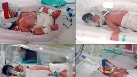 Hy hữu: Ca sinh 4 cùng trứng tự nhiên tại Australia