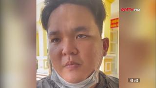 Đối tượng cướp tài sản của chủ quán cà phê sa lưới